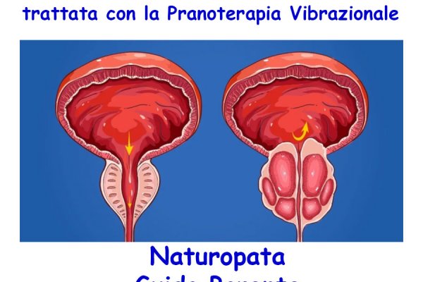 Schema di trattamento per la prostatite con consigli utili per la cura